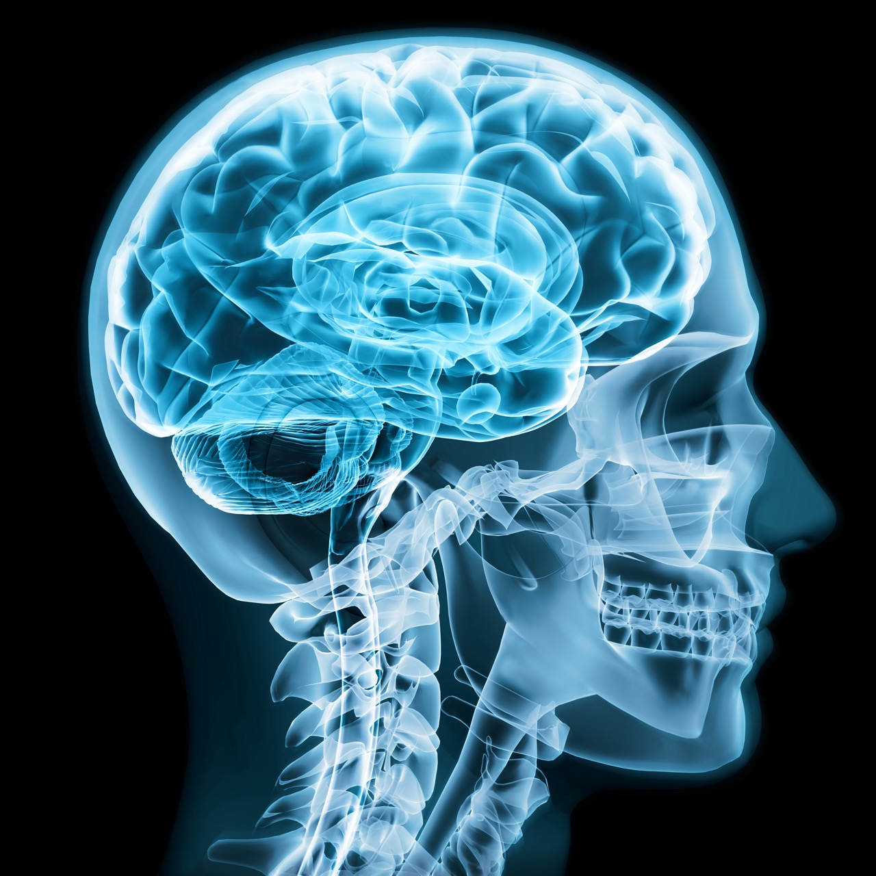 Peak Brainlab